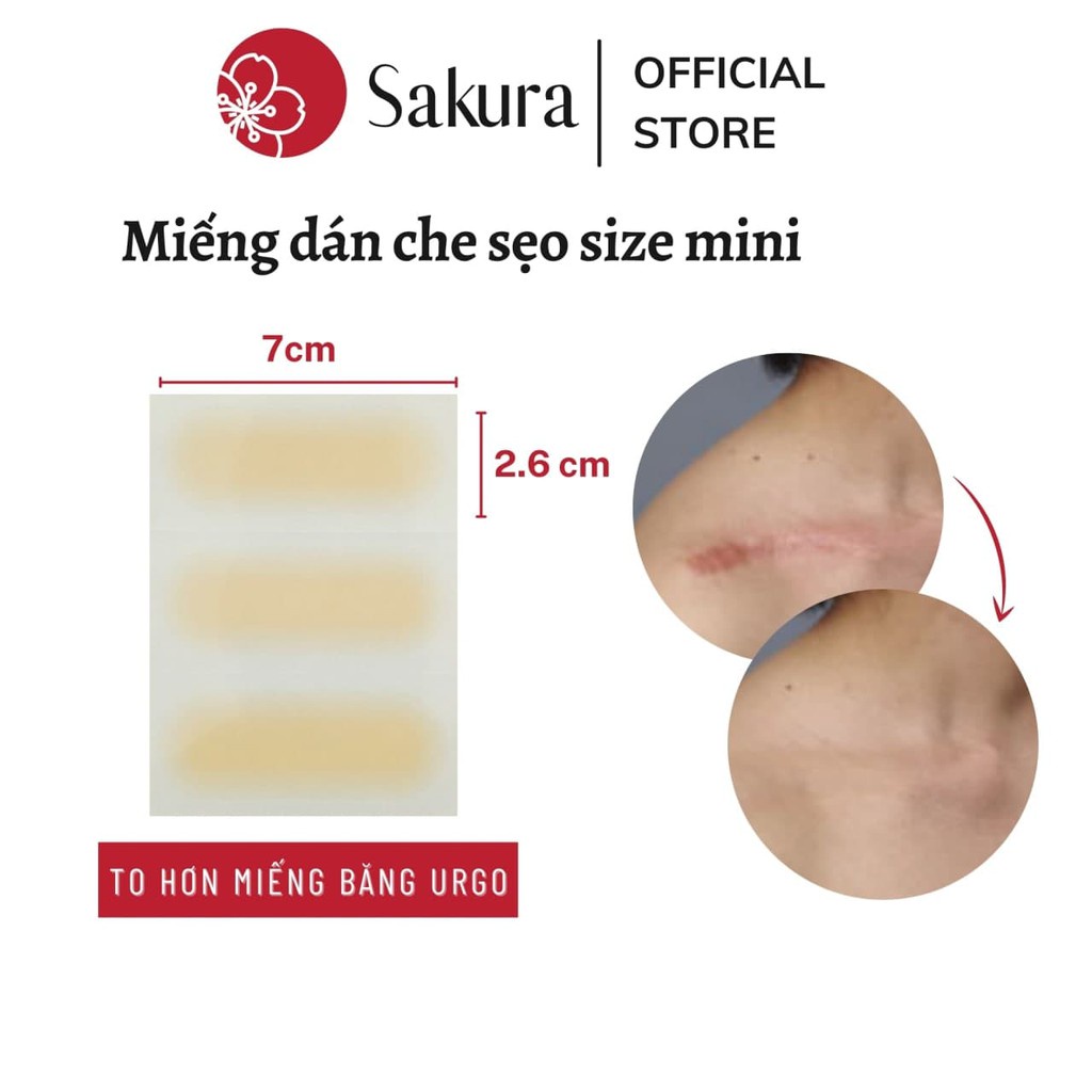 Miếng dán che sẹo Nhật Bản giúp bạn che đi những vết sẹo không mong muốn trên da. Với chất liệu an toàn và thiết kế sinh động, bạn sẽ cảm thấy tự tin và yêu bản thân hơn khi không lo lộ vết sẹo của mình. Hãy khám phá ngay hình ảnh liên quan để tìm hiểu thêm về sản phẩm này.